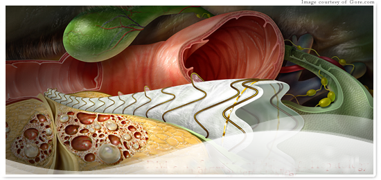 Internal Medicine & Gastroenterology