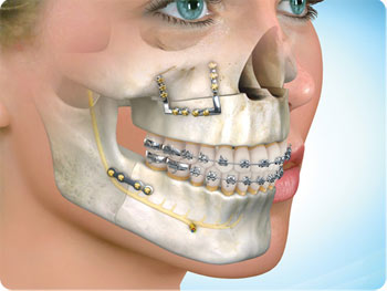 Oral Maxillofacial Surgeons