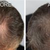 Christell  -  Hair Loss & Skin Clinic