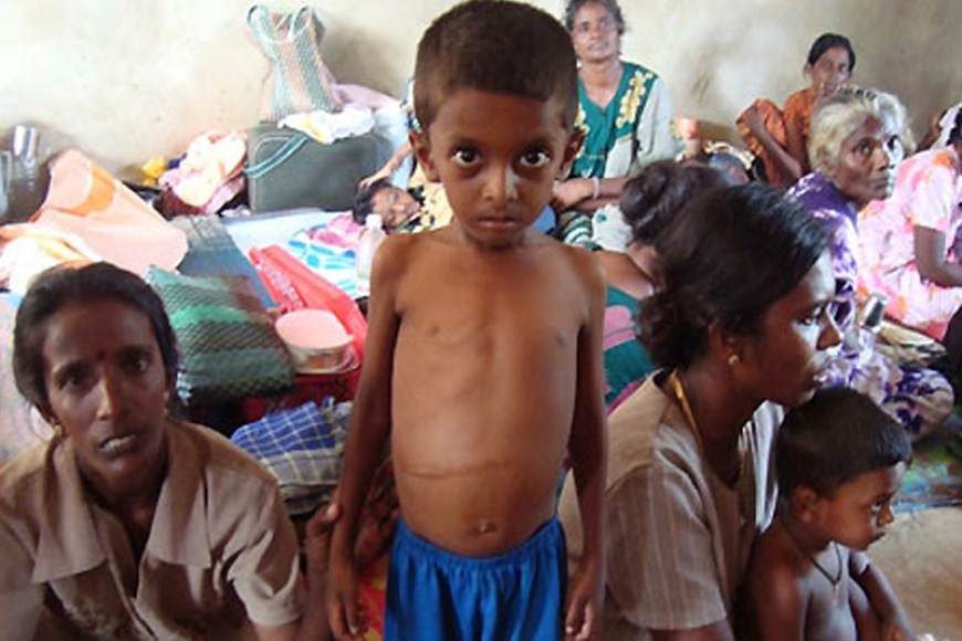 Sri Lanka rejects global report on child malnutrition