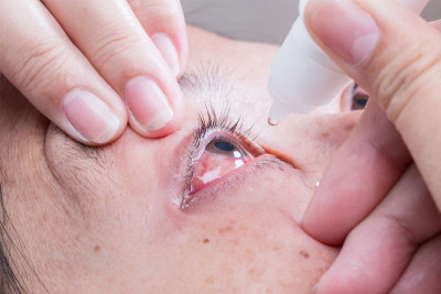 Indiana Ophthalmics showcaused by Pharmexcil after eye drop recall in Sri Lanka